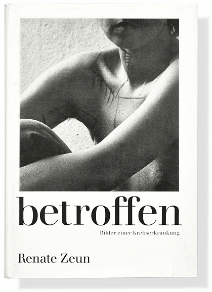 Renate Zeun: betroffen